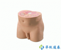 美國(guó)CIRS 801-P男性腹部/骨盤(pán)體模