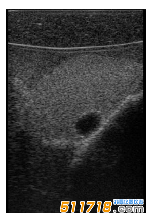 美國(guó)CIRS 074甲狀腺超聲訓(xùn)練模體1.png