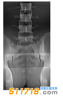 美國(guó)CIRS 034腰椎穿刺訓(xùn)練模體1.png