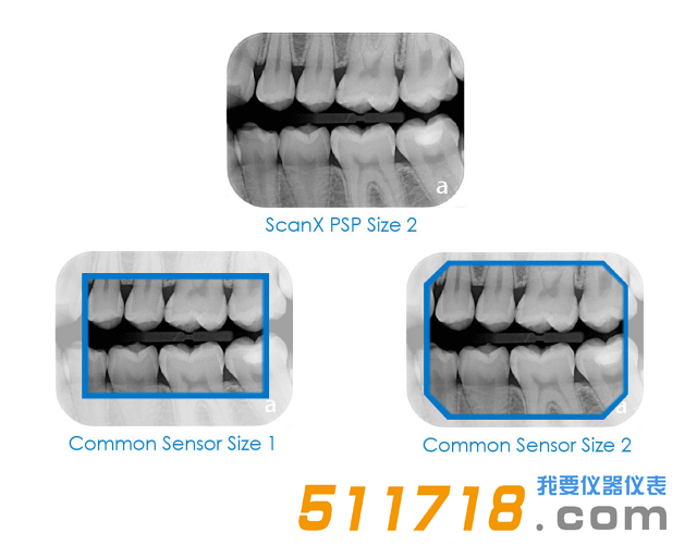 美國(guó)AIR TECHNIQUES ScanX Duo數(shù)字X射線(xiàn)系統(tǒng) 口腔掃描儀2.png